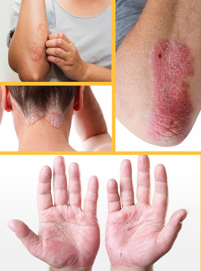 Best skin Hospital in Bathinda | Vasu Eye Institute & Skin Centre