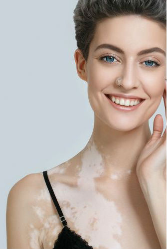 Best skin Hospital in Bathinda | Vasu Eye Institute & Skin Centre