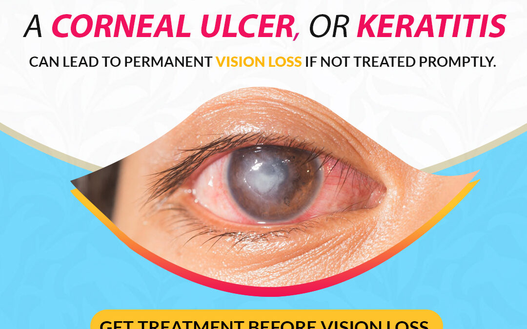Take care of your cornea with specialized eye care by experts at Best Eye Hospital in Bathinda