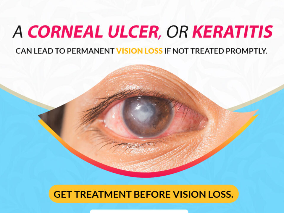 Take care of your cornea with specialized eye care by experts at Best Eye Hospital in Bathinda