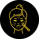 Acne (pimples) Treatment